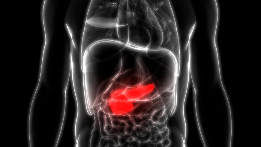 Kolecystit (inflammation i gallblåsan)